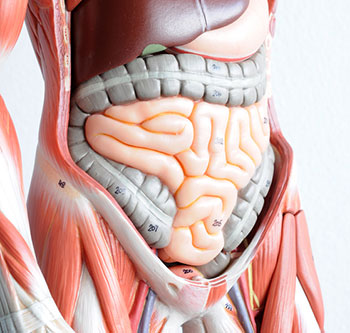 Distensión intestinal por enfermedad de Crohn