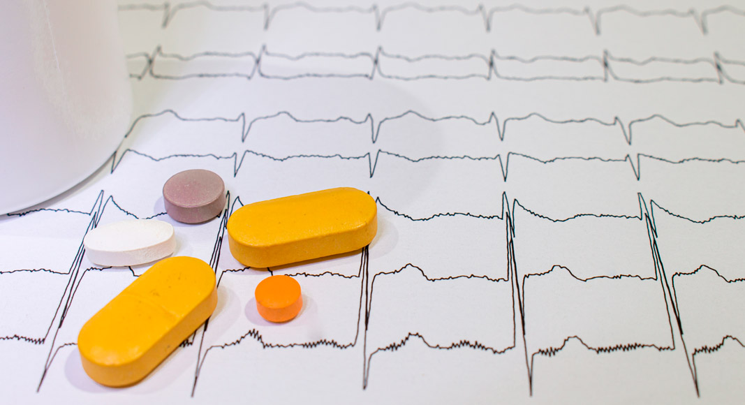 Arritmia provocada por medicamentos