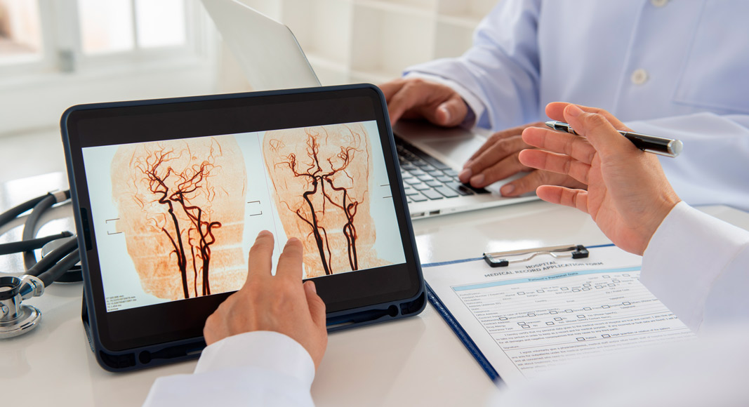 Tratamiento y diagnóstico de un aneurisma