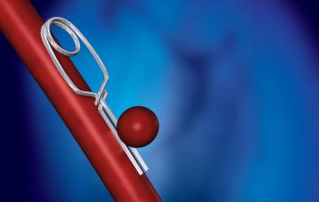 Cirugía de una aneurisma Tratamiento de una aneurisma