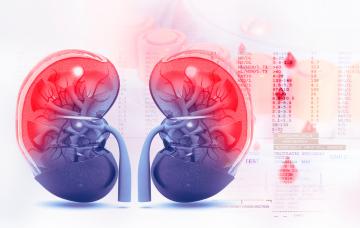 Creatinina alta, cómo bajar sus niveles Creatinina, fallo renal