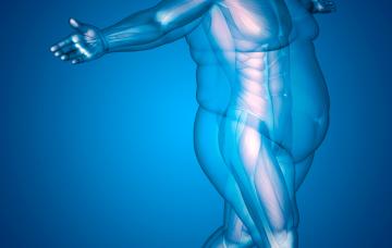 Síntomas de la obesidad Síntomas de la obesidad mórbida