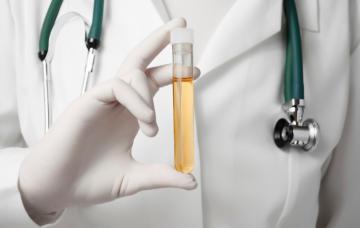 Análisis de orina Diagnóstico de la cistitis