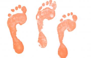 Estudio de la pisada Qué es el estudio de la pisada