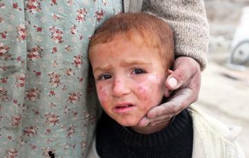 Cómo actuar después de un terremoto Niño después de haber sufrido un terremoto