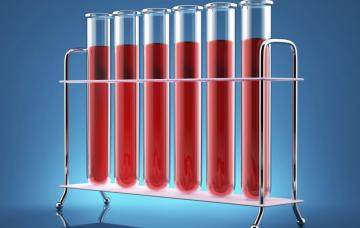 Analítica de sangre Muestras de análisis de sangre