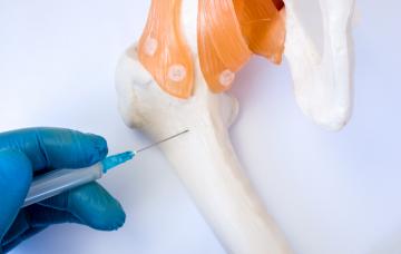 Qué es la biopsia de médula ósea Biopsia de médula ósea