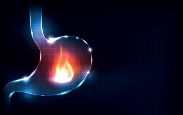 Síntomas del reflujo gastroesofágico Ardor, síntoma del reflujo gastroesofágico