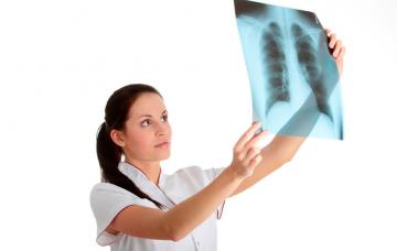 Edema pulmonar Qué es un edema pulmonar