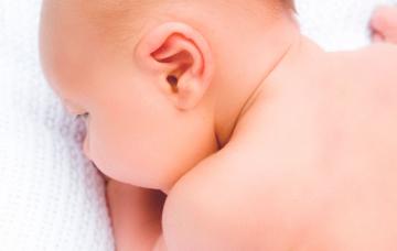 Bebé con espina bífida Espina bífida