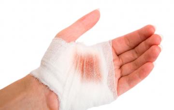 Heridas Primeros auxilios: heridas