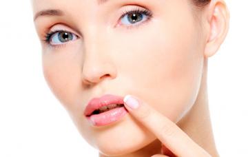 Herpes Qué es el herpes