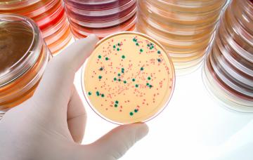 Infecciones vaginales Infecciones vaginales en placa de petri