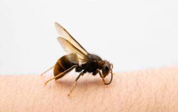 Picaduras de insecto Picaduras de insecto en un brazo