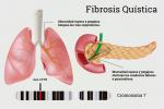 Infografía de las causas de la fibrosis quística