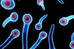 Clostridium tetanis, causa del tétanos Causas del tétanos