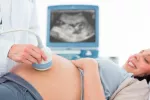 Tratamiento de la placenta previa Mujer haciéndose una radiografía