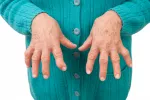 Causas de la artritis reumatoide Edad avanzada, causas de la artritis reumatoide