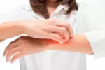 La dermatitis atópica se ha triplicado en las últimas tres décadas Paciente con dermatitis atópica