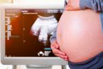 Ecografía de un mujer embaraza con el síndrome del gemelo evanescente