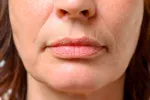 Xerostomía o sequedad bucal en personas mayores Sequedad bucal en personas mayores