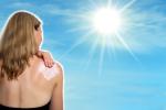Protección solar para evitar la alergia al sol