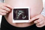 Mujer muestra la ecografía de su hijo después de ser trasplantada de útero