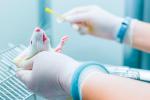 Tratamiento capaz de contener el avance de la ELA en ratones