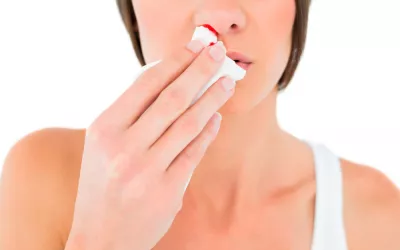 Hemorragia nasal Mujer con una hemorragia nasal