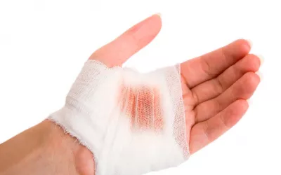 Heridas Primeros auxilios: heridas