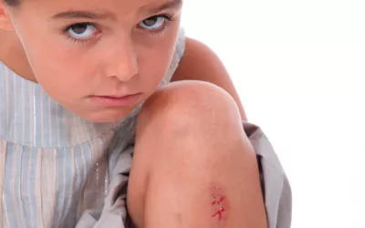 Raspaduras y laceraciones Niña con una raspadura que sangra en la pierna