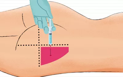 Cómo poner una inyección intramuscular