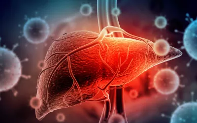 Virus de la hepatitis con hígado humano en 3D Virus de la hepatitis provocando un cáncer de hígado