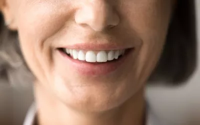 Esmalte dental restaurado y sano Mujer de mediana edad sonríe mostrando un saludable y blanco esmalte dental