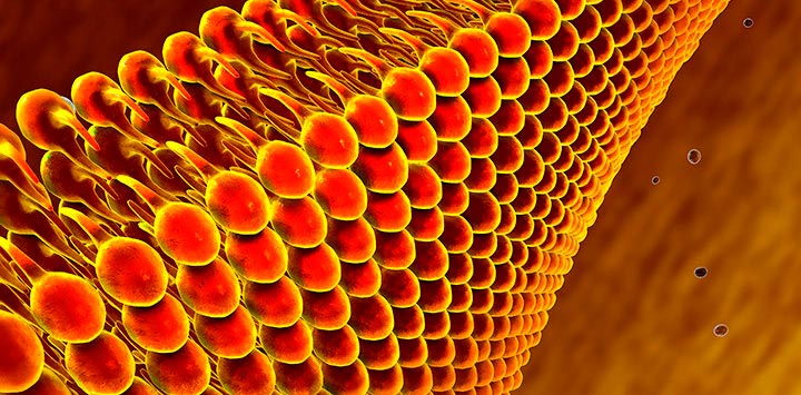 Hipertrigliceridemia