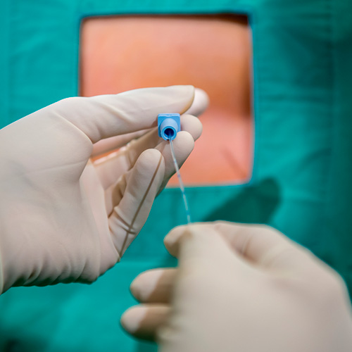 La anestesia epidural es una técnica de alto riesgo