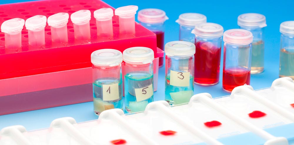 Biopsia líquida