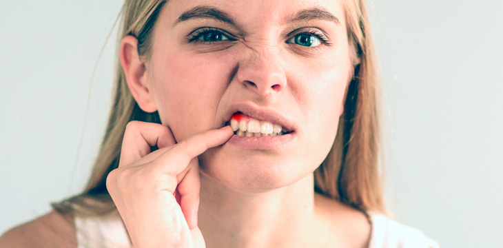 Color de las encías