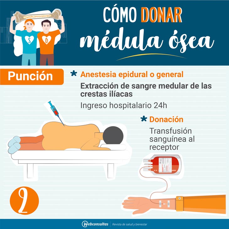 Donar médula, punción