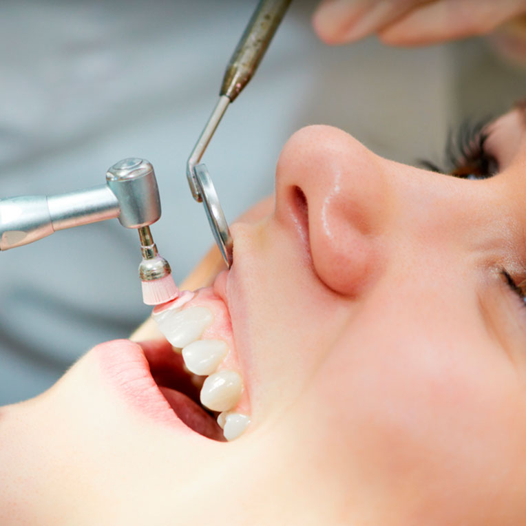 Limpieza profesional