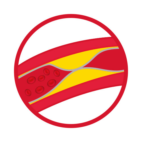 Reduce el colesterol