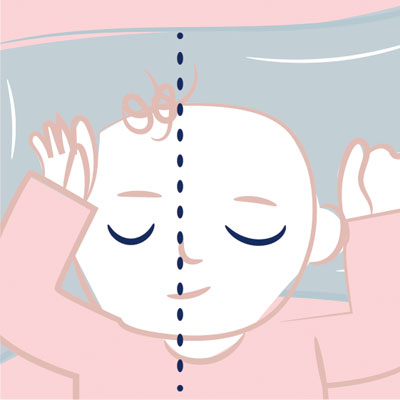 Asimetría facial: container baby
