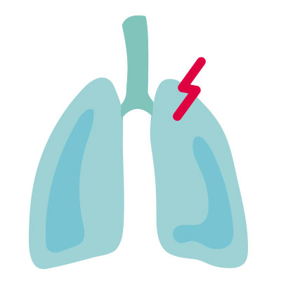 Problemas respiratorios: container baby