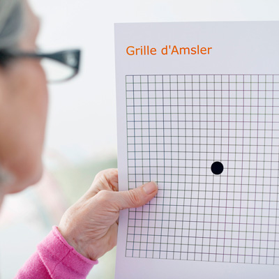 Degeneración macular
