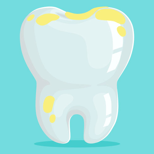 Manchas amarillas en los dientes
