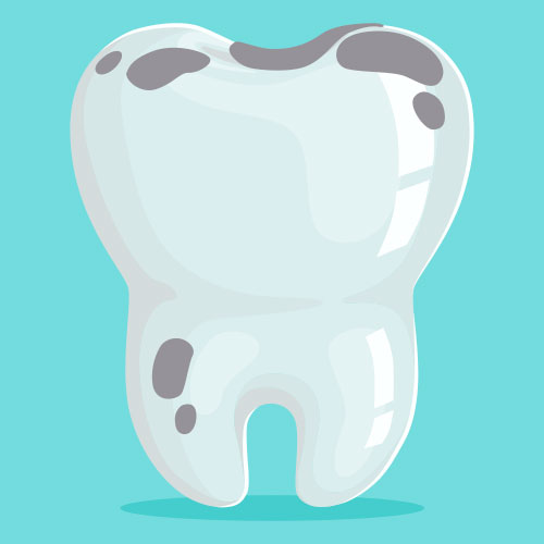 Manchas grises en los dientes