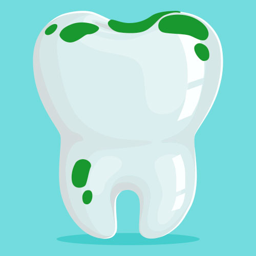 Manchas verdes en los dientes