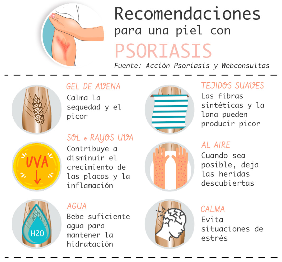 Recomendaciones para una piel sin psoriasis