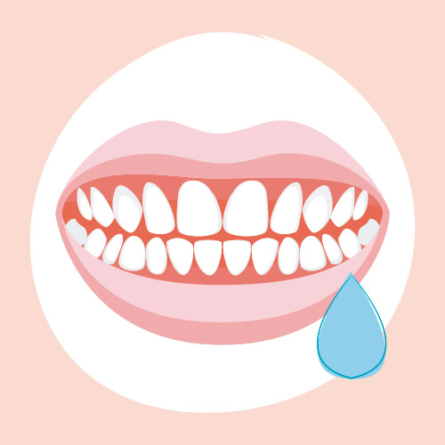 Salivación excesiva