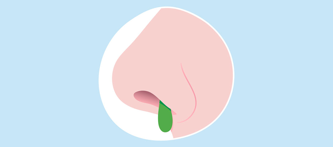 Color de los mocos: verde